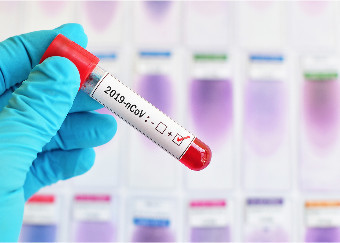 Risposta infiammatoria e suscettibilità a Covid-19