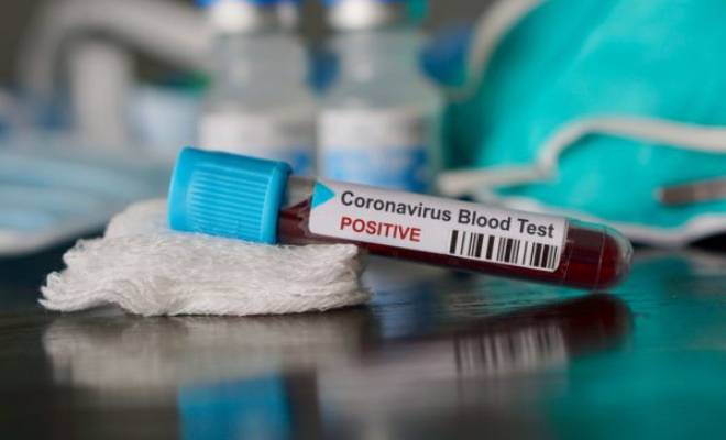 covid-19-lettera-aperta-dalle-tiws-top-italian-women-scientists-e-dal-network-di-ricerca-hiv covid-19-lettera-aperta-dalle-tiws-top-italian-women-scientists-e-dal-network-di-ricerca-hiv